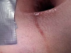 The best of my gaping asshole 2012 part 2 from 6