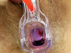 Her cramped vag feels astounding during a strong gyno exam