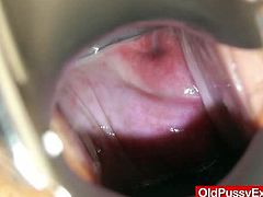 Courtesy of Old Pussy Exam you can see how a horny mature gets her hairy cunt examined by a nasty doctor who's ready to make it sure it still remains fully functional!