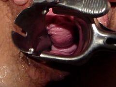 Speculum