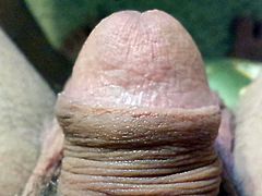 foreskin rolling back
