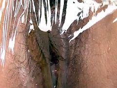 japanese URETHRA ILLUSTRATIONS6.mp4