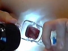 Russian girl in webcam with anal speculum