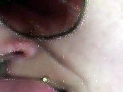 Frenulum cum