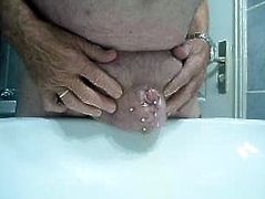 Penectomy  pee