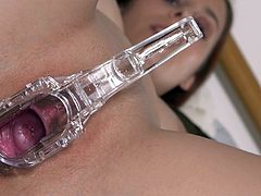 Antonia Sainz speculum cervix play